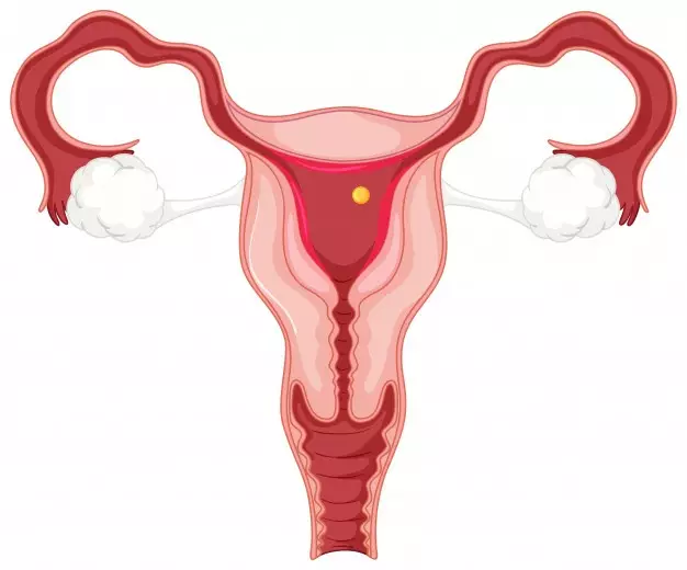 kunyit putih © berbagai sumber kunyit putih © berbagai sumber