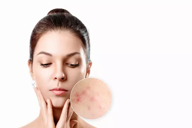 10 Manfaat kayu manis untuk kecantikan dan cara pakainya freepik.com 10 Manfaat kayu manis untuk kecantikan dan cara pakainya freepik.com