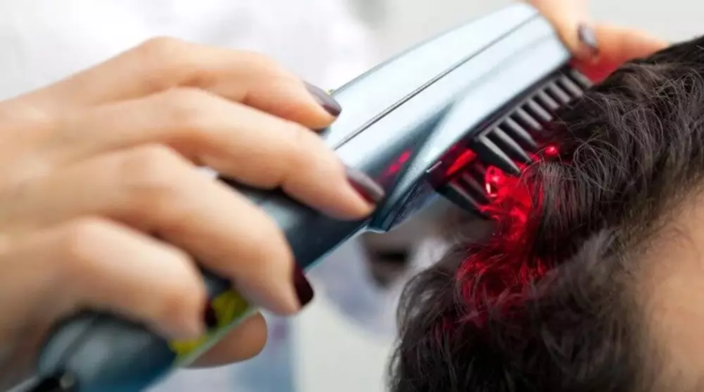 Tips mengatasi rambut rontok © 2020 brilio.net Tips mengatasi rambut rontok © 2020 brilio.net