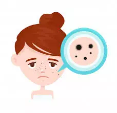 Es batu untuk kecantikan © 2020 brilio.net