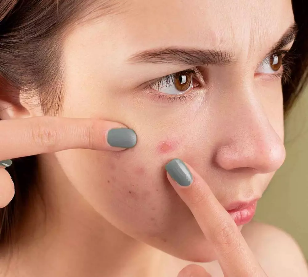 Manfaat pare untuk kecantikan © 2021 brilio.net