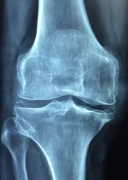 Manfaat alpukat untuk kecantikan dan kesehatan Berbagai sumber Manfaat alpukat untuk kecantikan dan kesehatan Berbagai sumber