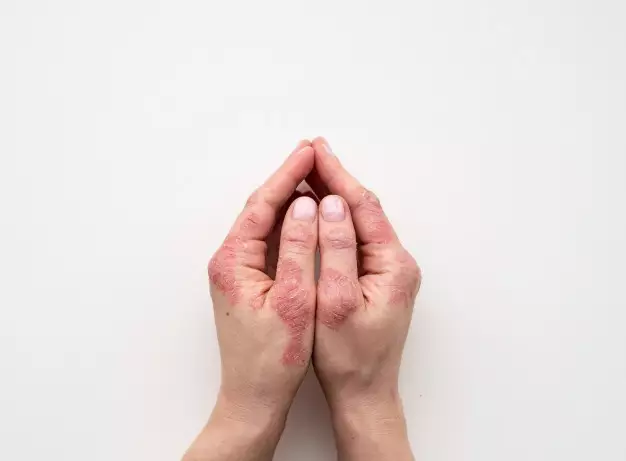 lavender untuk kecantikan © Stylecraze dan Herbaldynamicsbeauty lavender untuk kecantikan © Stylecraze dan Herbaldynamicsbeauty