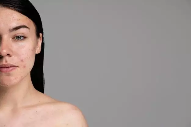 Manfaat tomat untuk wajah © 