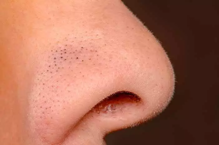 Manfaat sunscreen bagi wajah © 2022 brilio.net  Manfaat sunscreen bagi wajah © 2022 brilio.net