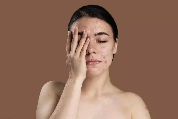 Manfaat vitamin C pada skincare Berbagai sumber Manfaat vitamin C pada skincare Berbagai sumber