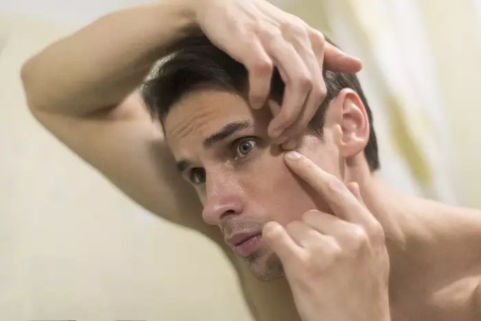 Penyebab munculnya panu di wajah Berbagai sumber