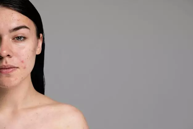 penyebab flek hitam di wajah © penyebab flek hitam di wajah ©