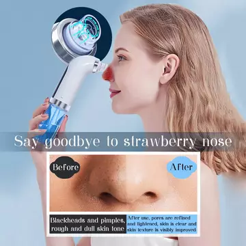 Daftar beauty gadget di bawah Rp 450 ribu Berbagai sumber