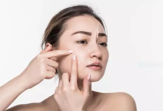 Cara atasi kulit tidak cocok dengan skincare freepik.com Cara atasi kulit tidak cocok dengan skincare freepik.com
