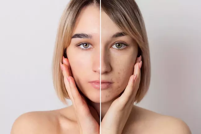 Manfaat menggunakan primer Freepik.com Manfaat menggunakan primer Freepik.com