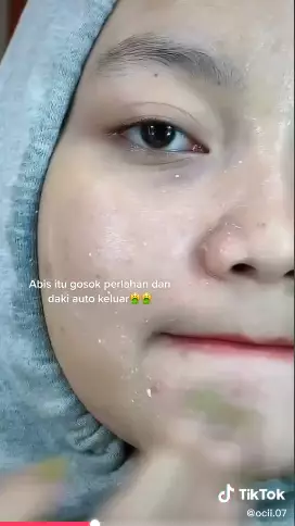 urutan eksfoliasi wajah  Berbagai sumber