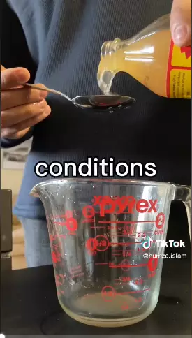 Tips simple atasi ketombe menggunakan apple cider vinegar Berbagai sumber