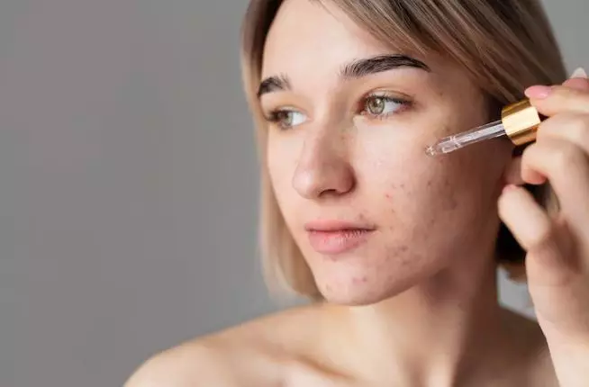 Tips gunakan acne patch agar lebih efektif freepik.com