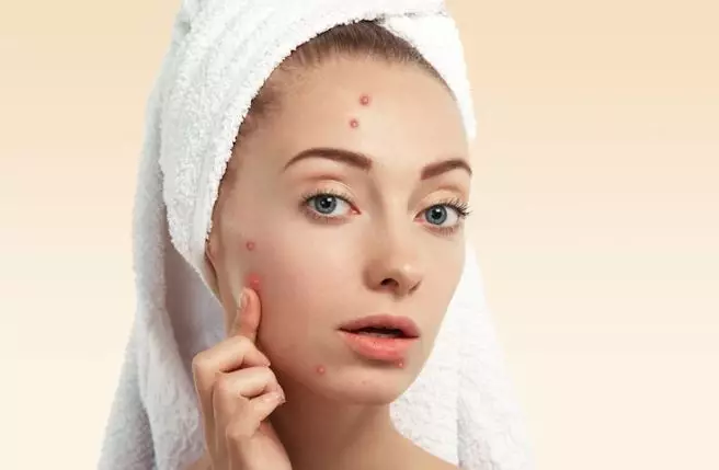 Tips gunakan acne patch agar lebih efektif freepik.com