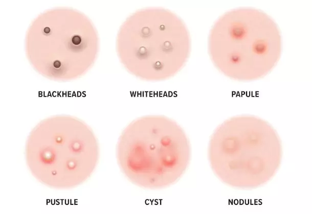 Tips gunakan acne patch agar lebih efektif freepik.com