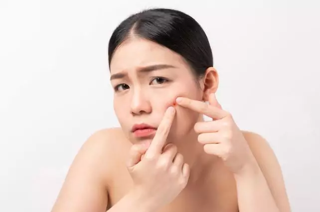 Tips gunakan acne patch agar lebih efektif freepik.com
