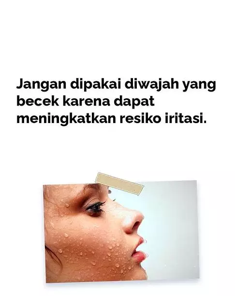 Tips cegah iritasi saat memakai retinol ala dokter kulit Instagram
