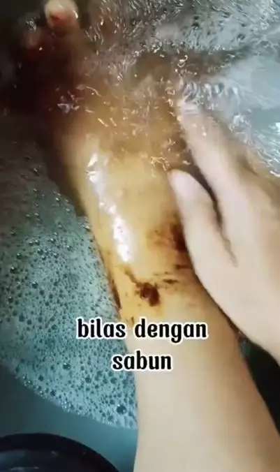 Cara membuat scrub untuk atasi kulit belang pakai bahan dapur TikTok