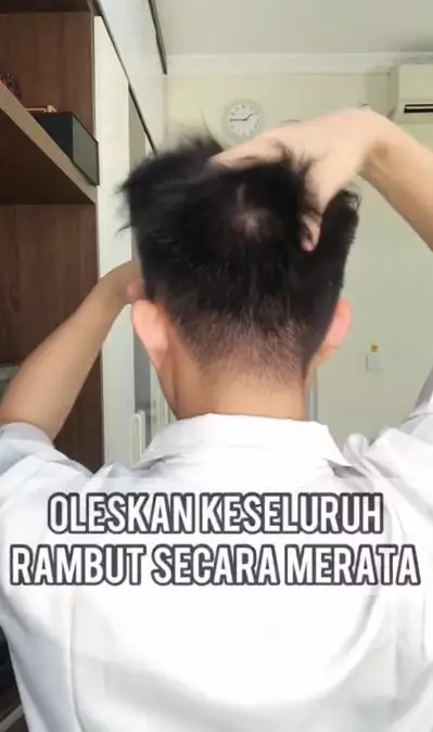 Cara menghilangkan kutu rambut pakai 2 bahan alami TikTok Cara menghilangkan kutu rambut pakai 2 bahan alami TikTok