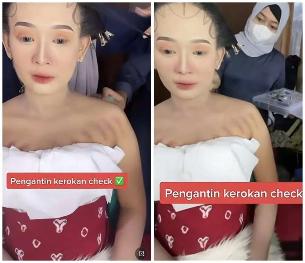 wanita dirias MUA pas ada bekas kerokan © berbagai sumber