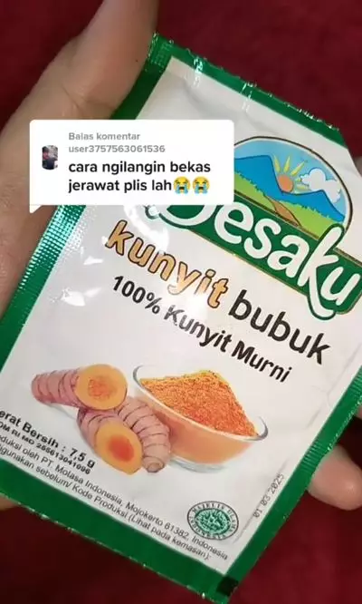 Tips menghilangkan bekas jerawat pakai 3 bahan dapur Berbagai sumber Tips menghilangkan bekas jerawat pakai 3 bahan dapur Berbagai sumber