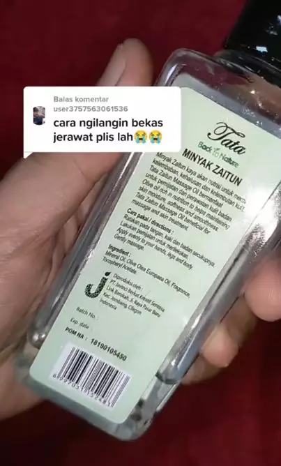 Tips menghilangkan bekas jerawat pakai 3 bahan dapur Berbagai sumber Tips menghilangkan bekas jerawat pakai 3 bahan dapur Berbagai sumber