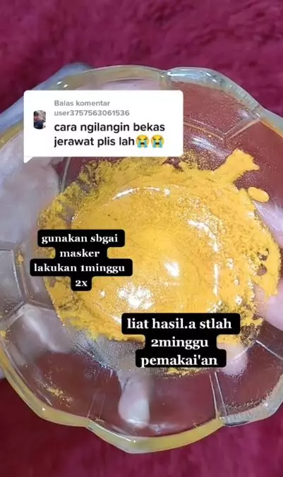 Tips menghilangkan bekas jerawat pakai 3 bahan dapur Berbagai sumber Tips menghilangkan bekas jerawat pakai 3 bahan dapur Berbagai sumber