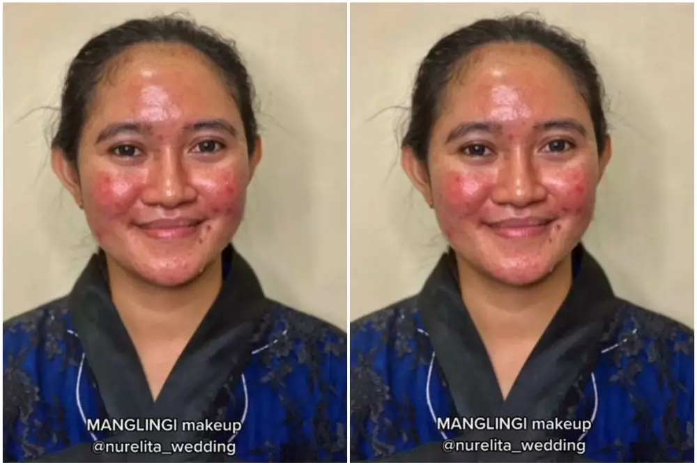transformasi wanita berjerawat jadi pengantin © TikTok