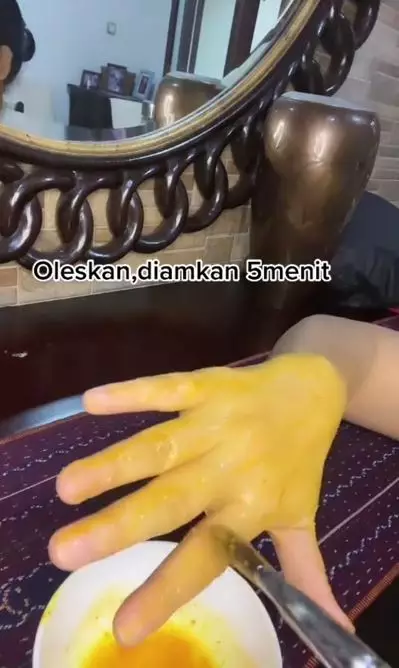 Cara menghilangkan kerutan pada tangan cuma pakai 4 bahan dapur Berbagai sumber Cara menghilangkan kerutan pada tangan cuma pakai 4 bahan dapur Berbagai sumber