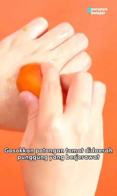 Cara menghilangkan jerawat punggung pakai 1 jenis buah Berbagai sumber Cara menghilangkan jerawat punggung pakai 1 jenis buah Berbagai sumber