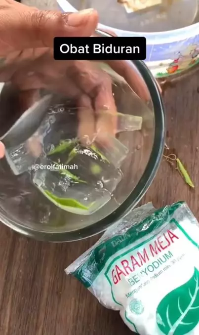 Cara atasi biduran secara alami pakai 3 bahan dapur Berbagai sumber Cara atasi biduran secara alami pakai 3 bahan dapur Berbagai sumber