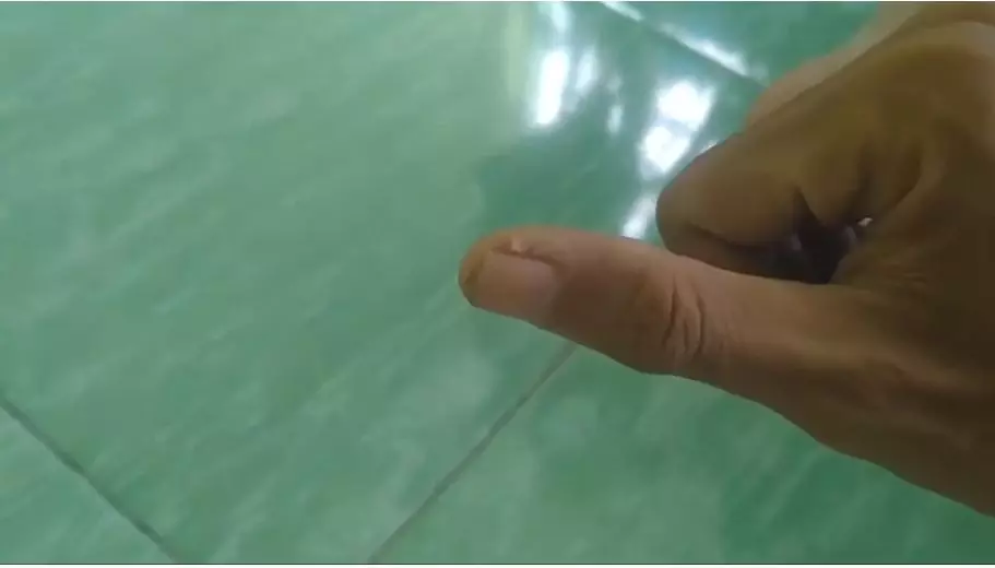 trik hilangkan kulit mengelupas di sekitar kuku berbagai sumber