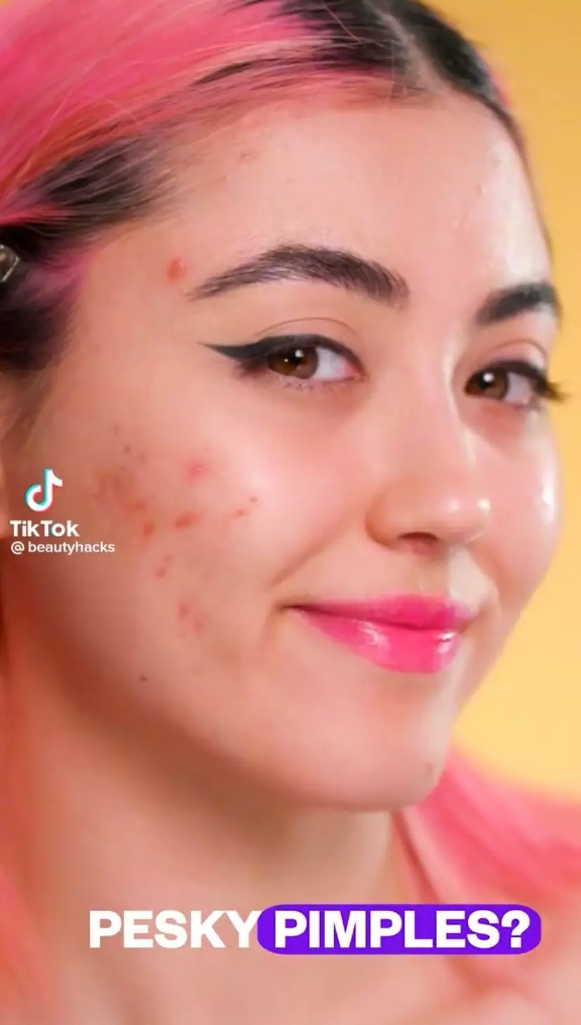 Masker wajah 1 bahan dapur samarkan bekas jerawat © 2023 berbagai sumber Masker wajah 1 bahan dapur samarkan bekas jerawat © 2023 berbagai sumber