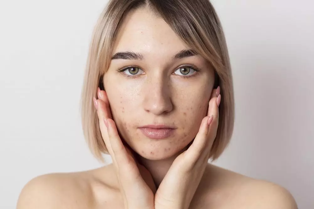 manfaat mugwort untuk kesehatan kulit wajah © 2023 brilio.net manfaat mugwort untuk kesehatan kulit wajah © 2023 brilio.net