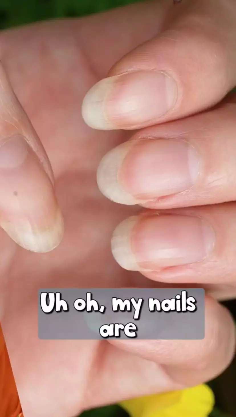 Trik bersihkan kuku kusam Istimewa