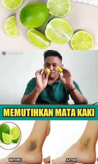 Memutihkan mata kaki hitam dengan 1 jenis buah-buahan Berbagai sumber