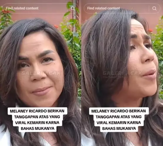 Melaney Ricardo wajah bopeng © TikTok