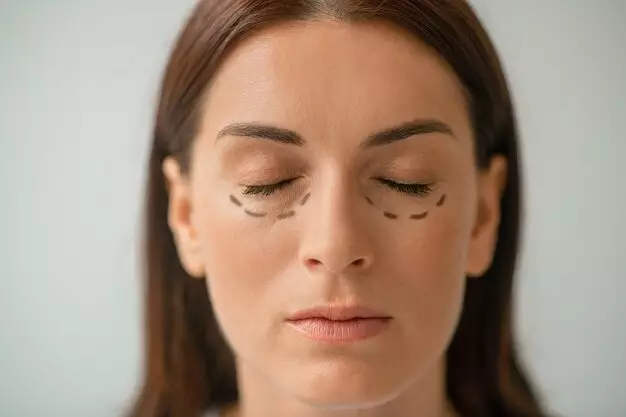 MUA anticreasing © Instagram MUA anticreasing © Instagram