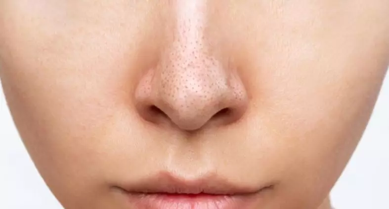 13 Cara mengecilkan pori-pori wajah Berbagai sumber