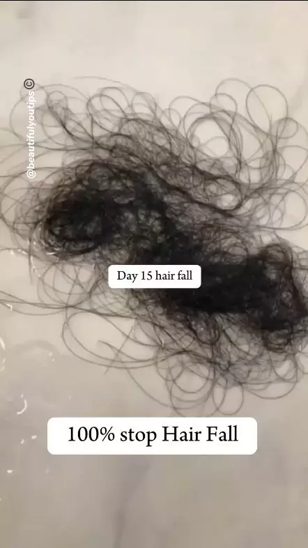 tunjukkan cara tumbuhkan lagi rambut rontok berbagai sumber