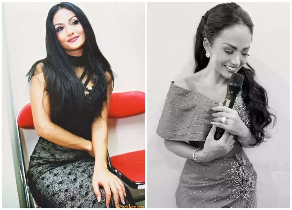 Potret sebelum dan sesudah 9 seleb sedot lemak berbagai sumber