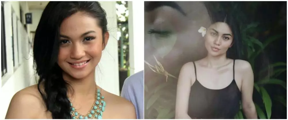 Potret sebelum dan sesudah 9 seleb sedot lemak berbagai sumber