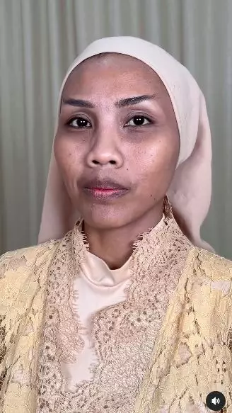 wajah wanita berflek hitam dan kulit kusam berbagai sumber wajah wanita berflek hitam dan kulit kusam berbagai sumber