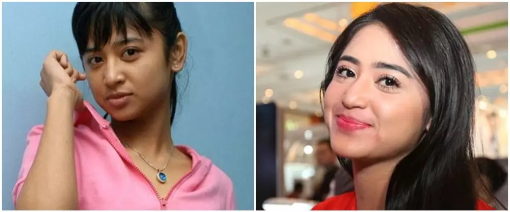 sebelum dan sesudah 9 seleb lakukan sulam bibir berbagai sumber