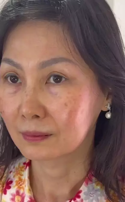 Ibu-ibu wajah flek hitam dirias bak model TikTok