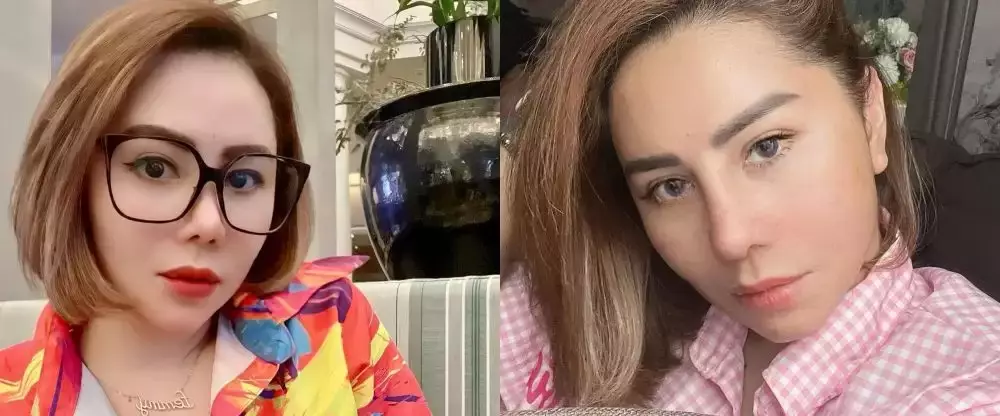 Seleb sebelum dan sesudah face lifting Berbagai sumber