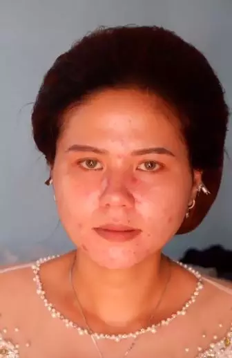 Transformasi makeup wajah berjerawat beda dengan wajah asli TikTok Transformasi makeup wajah berjerawat beda dengan wajah asli TikTok