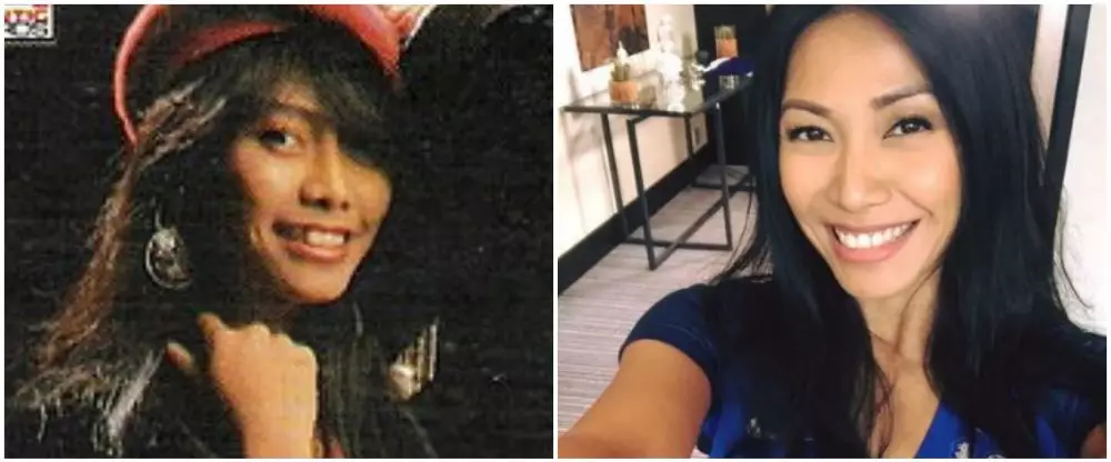 Seleb sebelum dan sesudah hilangkan gigi gingsul berbagai sumber Seleb sebelum dan sesudah hilangkan gigi gingsul berbagai sumber