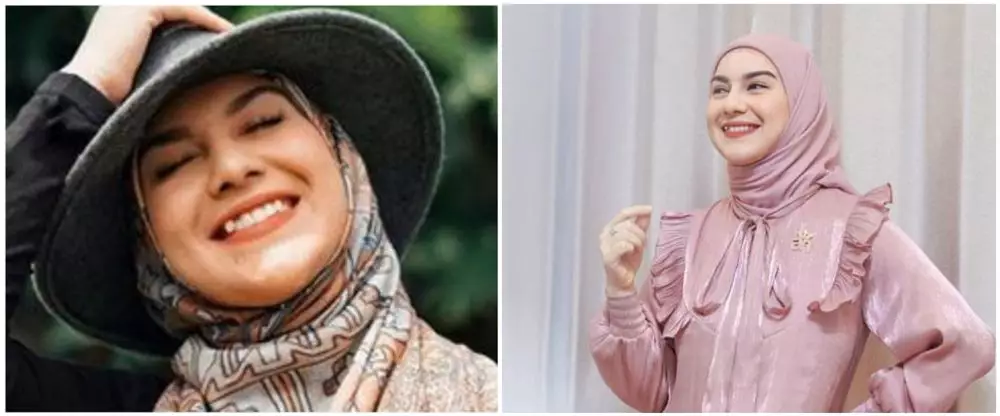 Seleb sebelum dan sesudah hilangkan gigi gingsul berbagai sumber Seleb sebelum dan sesudah hilangkan gigi gingsul berbagai sumber